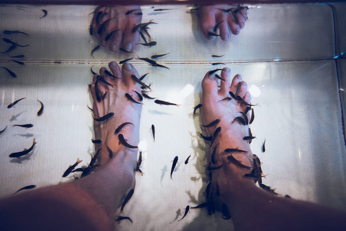 Yufuin Doctor Fish
